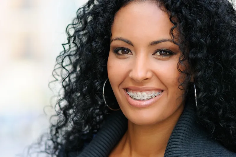 Woman showing a beautiful smile with braces